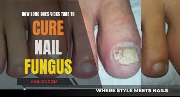 Vicks VapoRub: Effective Nail Fungus Treatment?