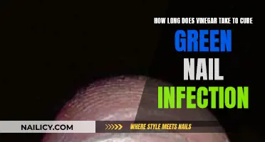 Vinegar Treatment for Green Nail Infections: How Long Does It Take?