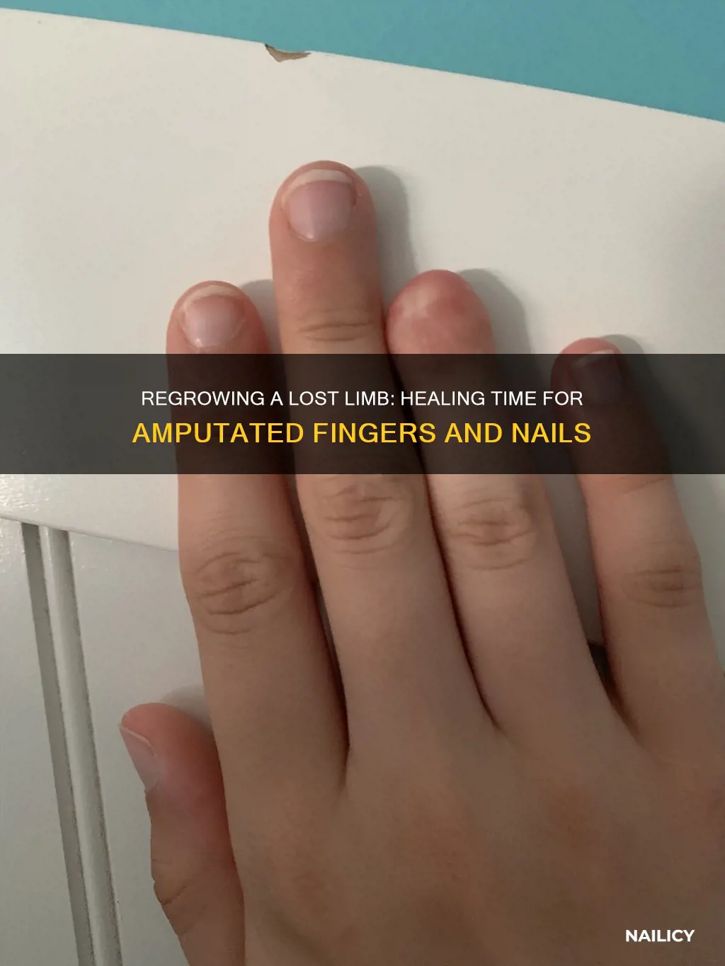 how long for a amputated finger and nail to heal