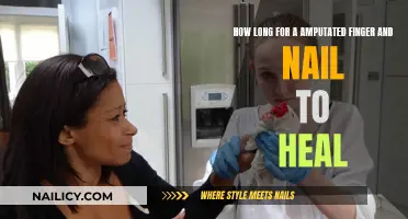 Healing Amputated Fingers: Time and Nail Recovery Process