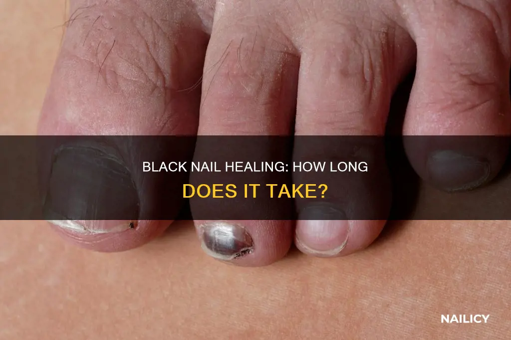 how long for a black nail to heal