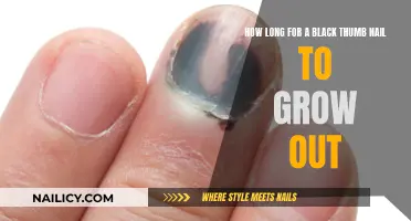 Black Thumb Nail: Time to Grow Out