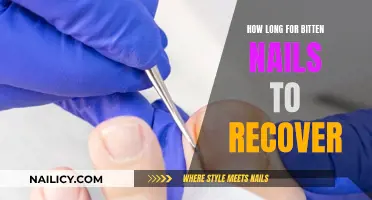 Healing Bitten Nails: What's the Timeline?