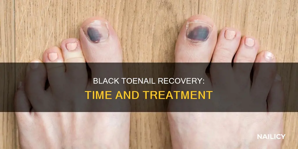 how long for black toe nail to go away