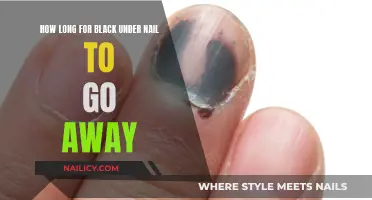 Black Under Nail: How Long Before It Disappears?