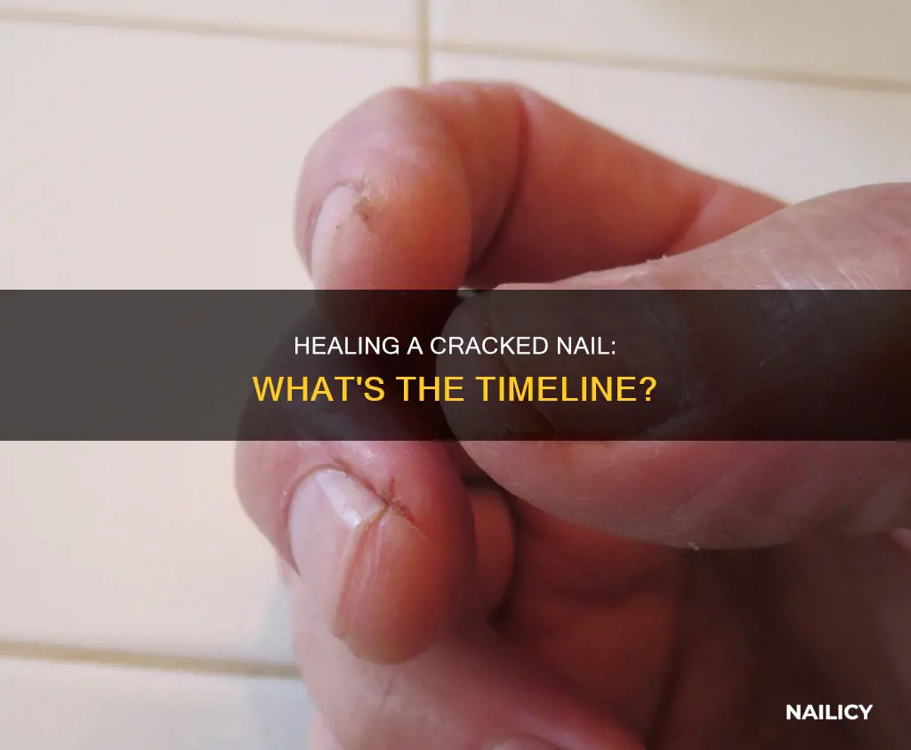 how long for crcked nail to heal