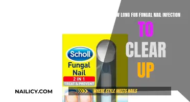 Fungal Nail Infections: How Long to Recover?