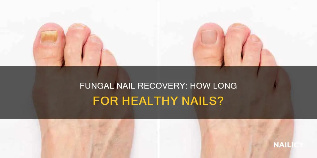 how long for fungal nail to grow out