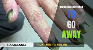 Green Nails: How Long Before They Heal?