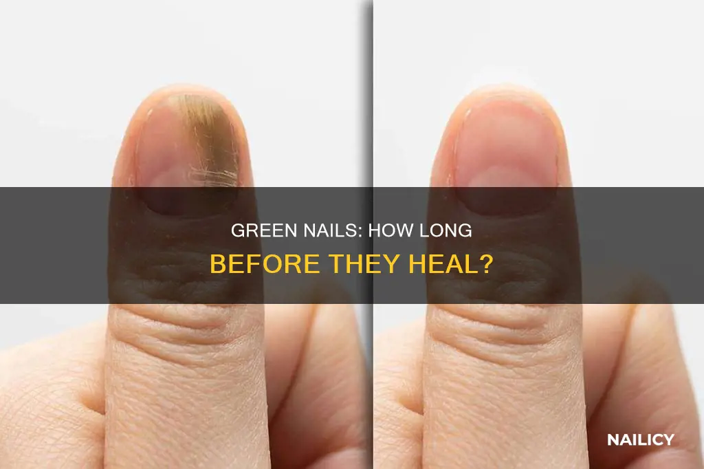 how long for green nail to go away