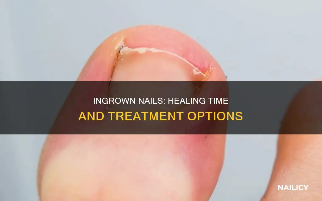 how long for ingornw nail to heal
