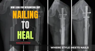 Intramedullary Nailing: Understanding the Healing Timeline