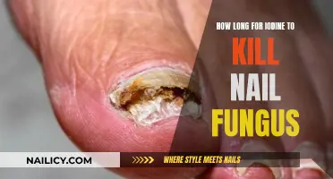 Iodine Treatment for Nail Fungus: How Long Does It Take?