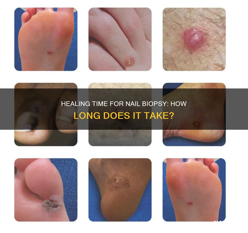 how long for nail biopsy to heal
