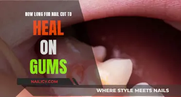 Healing Time: Gum Cuts from Nail Trims