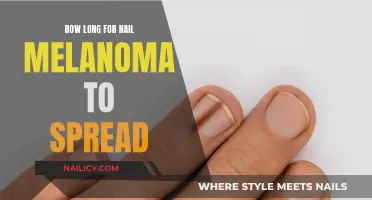 Nail Melanoma Progression: Understanding the Timeline of Spread