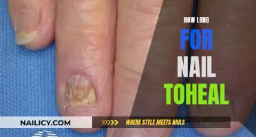 Healing Nails: Time to Recover and What to Expect