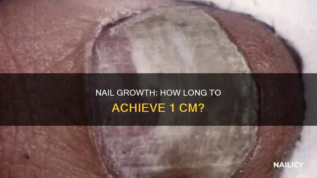 how long for nails to grow 1 cm