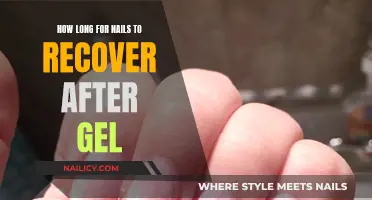 Gel Nails: Recovery Time and Aftercare for Healthy Nails
