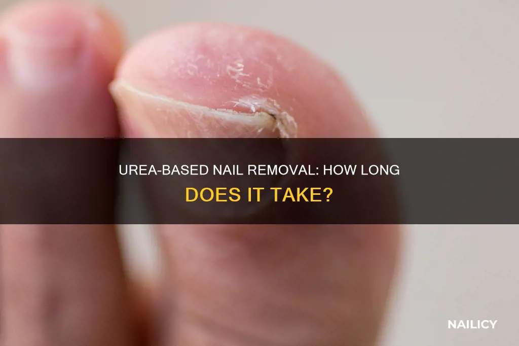 how long for urea to remove nail