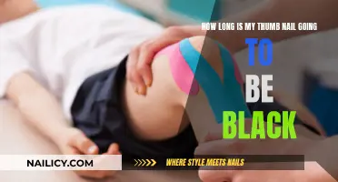 The Thumbnail Conundrum: How Long Will It Stay Black?