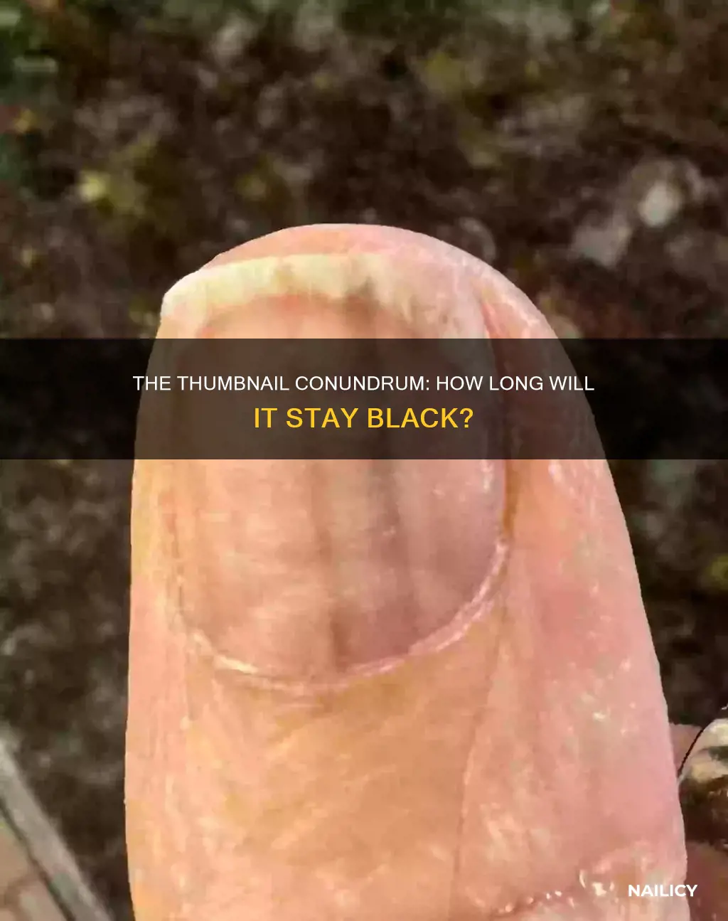 how long is my thumb nail going to be black