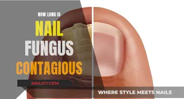 Nail Fungus: Understanding Its Contagious Period