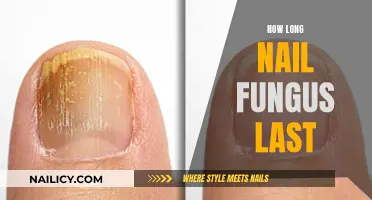 Battling Nail Fungus: How Long Will It Last?