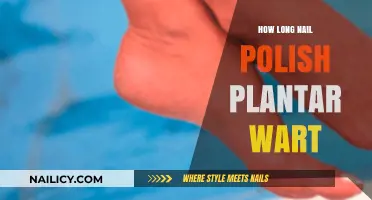 Nail Polish for Plantar Warts: Duration and Effectiveness Explained
