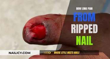 Painful Nail Ripping: How Long Does It Hurt?