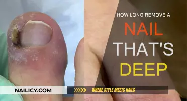Nail Removal: A Quick Guide to Speedy Recovery
