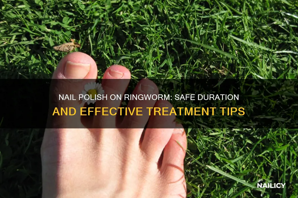 how long should i leave nail polish on ring worm