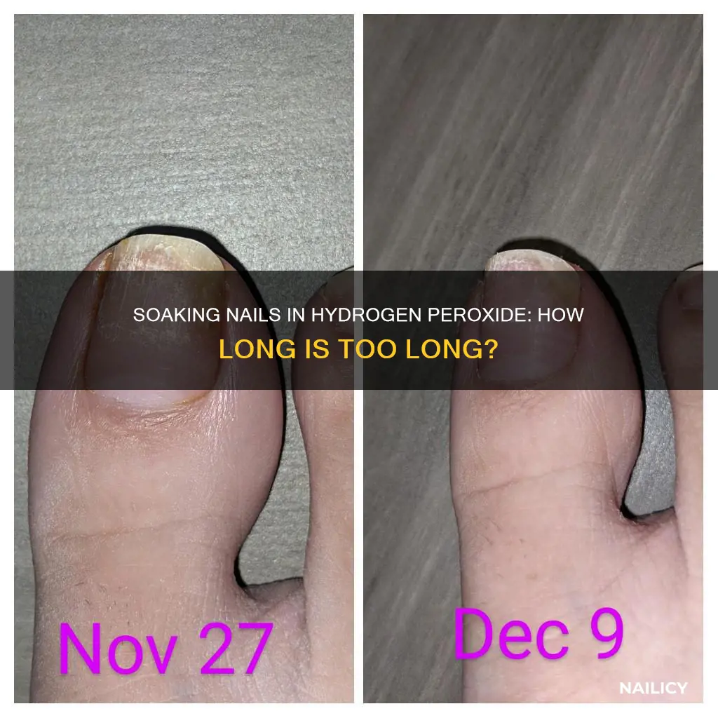 how long should i soak my nails in hydrogen peroxide