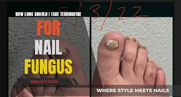 Terbinafine Treatment Duration for Nail Fungus