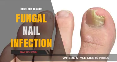 Eradicating Fungal Nail Infections: How Long Does It Take?