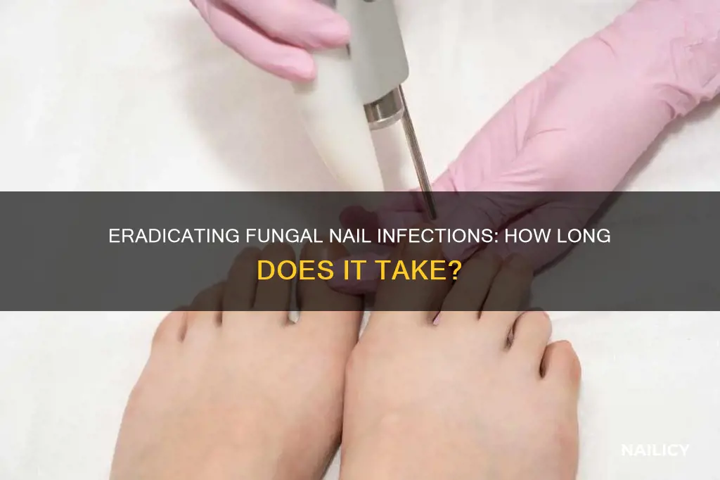 how long to cure fungal nail infection
