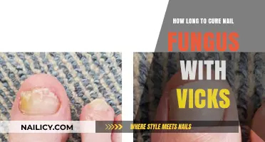 Vicks Vaporub: An Effective Nail Fungus Treatment?