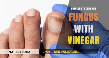 Vinegar Treatment for Nail Fungus: How Long Does It Take?
