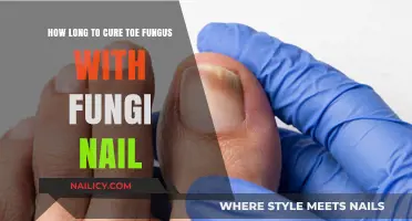 Fungi Nail: Effective Treatment for Toe Fungus