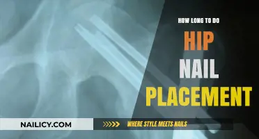 Hip Nail Placement: A Quick Guide to Recovery Time