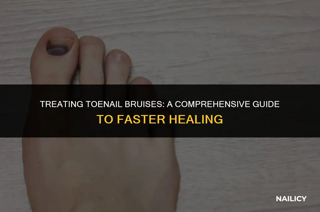 how long to get rid of bruise on toe nail