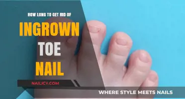 Banish Ingrown Toenails: A Comprehensive Guide to Quick Relief