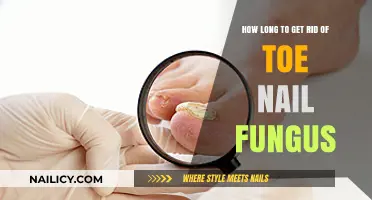 Effective Remedies to Eliminate Toenail Fungus Fast