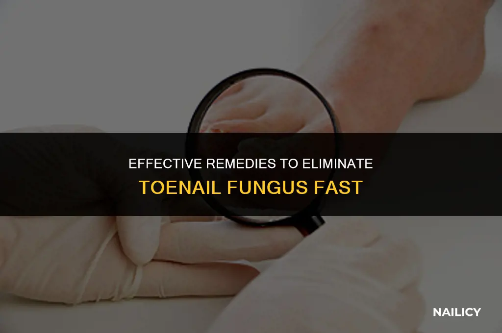 how long to get rid of toe nail fungus