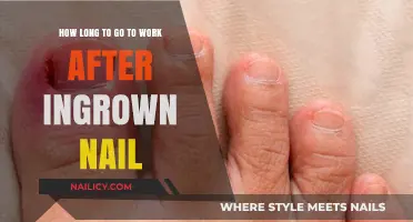 Ingrown Nail: When Can You Return to Work?