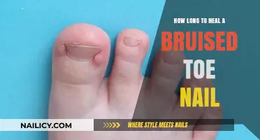 Healing a Bruised Toenail: What's the Timeline?