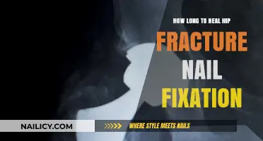 Healing Time for Hip Fracture Nail Fixation
