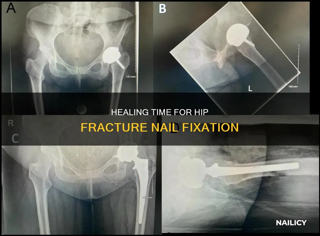 how long to heal hip fracture nail fixation
