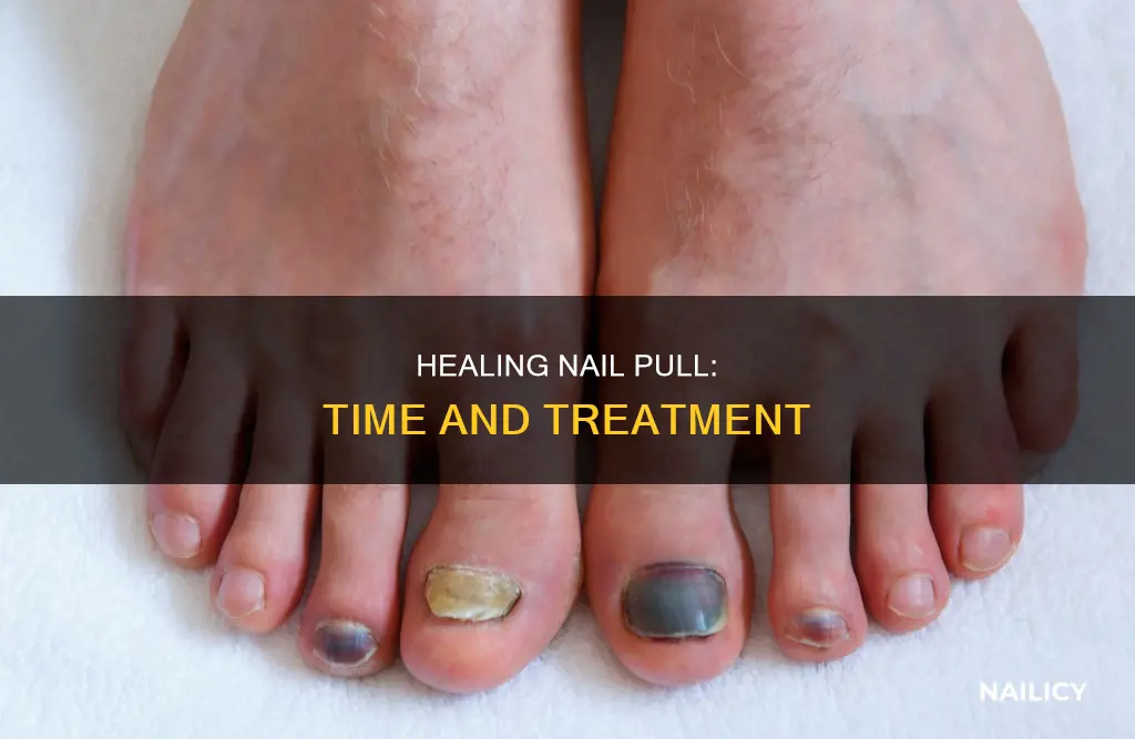 how long to heal nail pull