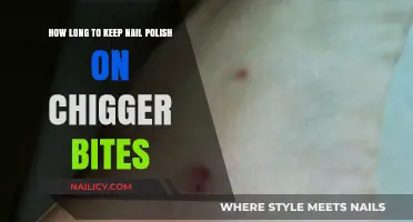 Nail Polish on Chigger Bites: How Long Should You Keep It On?